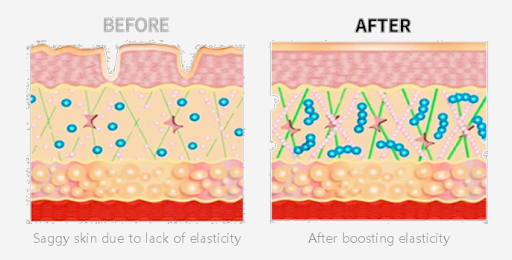 PDX5 SKIN BOOSTER - FAROHA