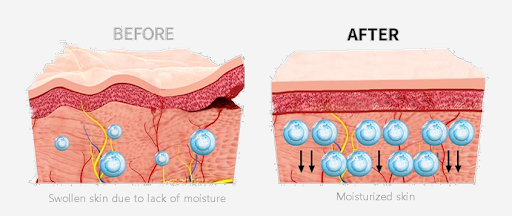 PDX5 SKIN BOOSTER - FAROHA